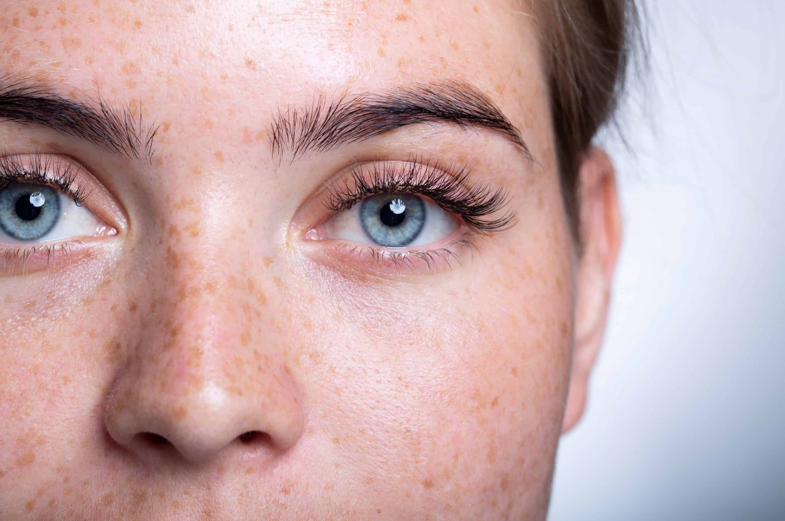 Cute skin girl with freckles, blue eyes. Looks at the camera. Portrait, close-up. On a white background.