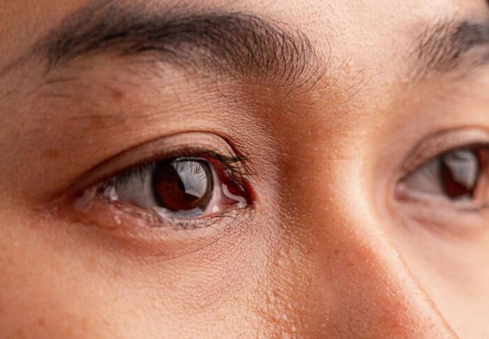 Close up of woman with tears.