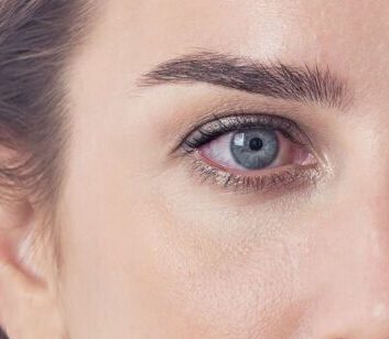 Woman having dry eye issue.